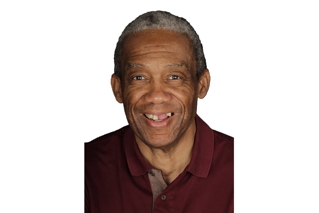 Case 52, smile makeover: smile before treatment by prosthodontist Dr. Esam Nahlah, Northern Virginia