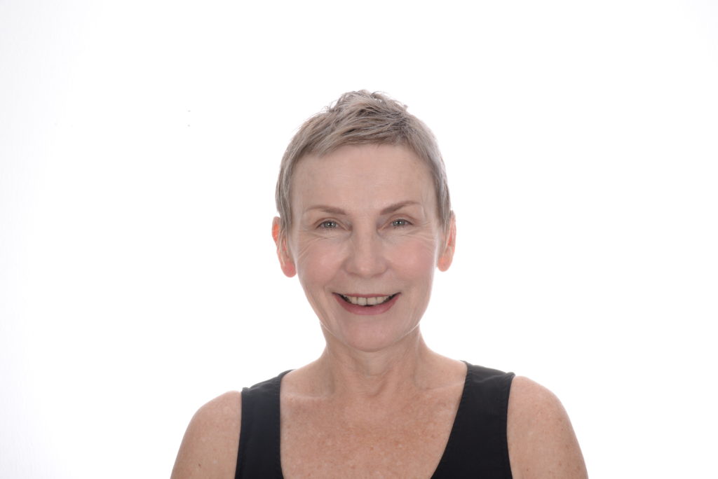 Case 50, smile makeover: smile before treatment by prosthodontist Dr. Esam Nahlah, Northern Virginia