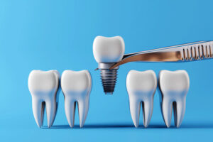 Dental implants and Healthy white teeth, picked up by dental tweezers. Oral health and dental inspection teeth.